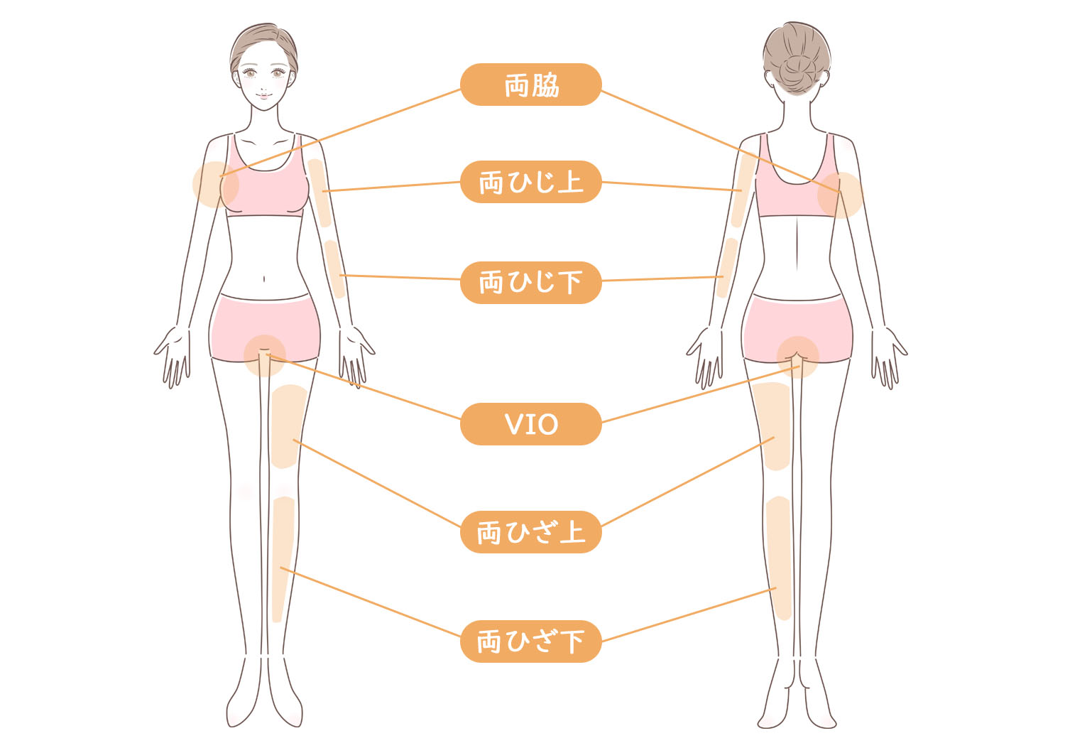脱毛部位_女性ボディ